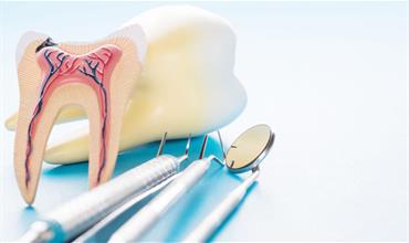 با انواع روش‌های درمان ریشه دندان آشنا شوید.
